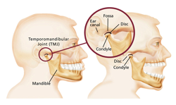 Temporomandibular Joint | TMJ | Dysfunction